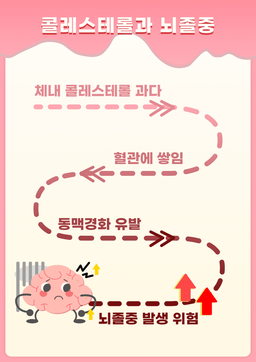 콜레스테롤이 너무 많으면 어떻게 될까요? 우리 몸에 콜레스테롤이 너무 많이 쌓이면 혈관에 붙어 동맥이 좁아지거나 딱딱해질 수 있습니다. 이것이 동맥경화라는 건데요, 이렇게 되면 뇌졸중 발생 위험이 높아집니다.