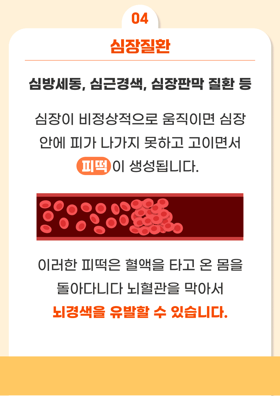 네 번째 위험 인자로는 심장질환이 있습니다. 심장은 온 몸에 혈액을 보내주는 장기로, 심장이 비정상적으로 움직이면 심장 안에 피가 나가지 못하고 고이면서 피떡이 생성됩니다. 이러한 피떡은 혈액을 타고 온 몸을 돌아다니다 뇌혈관을 막아서 뇌경색을 유발할 수 있습니다. 모든 심장질환이 뇌졸중의 위험 인자는 아니며, 피떡을 잘 생성할 수 있는 질환으로는 심방세동과 같은 부정맥 및 심근경색, 심장판막 질환 등으로 알려져 있습니다. 이러한 질환을 진단 받은 경우 피떡이 생기는 것을 예방하기 위해 항혈전제와 같은 약물치료가 필요합니다.