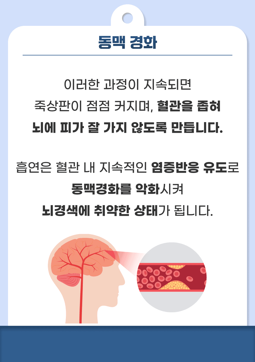 이러한 과정이 지속되면 죽상판이 점점 커지며 혈관을 좁혀 뇌에 피가 잘 가지 않도록 만듭니다. 흡연은 혈관 내 지속적인 염증반응 유도로 동맥경화를 악화시켜 뇌경색에 취약한 상태가 됩니다.