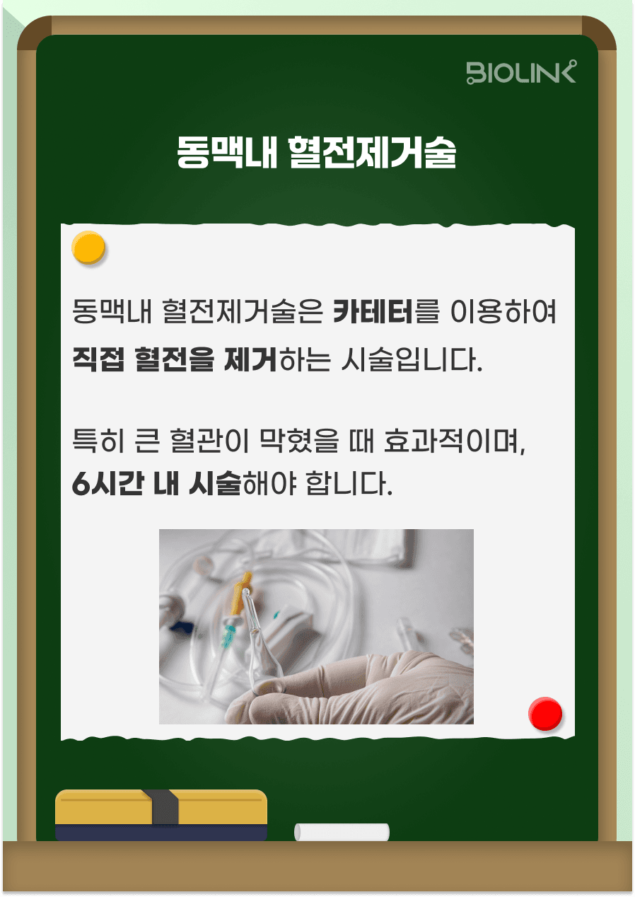 동맥 내 혈전제거술은 혈관에 카테터를 직접 삽입하여 혈관을 막고 있는 혈전을 직접 제거하는 시술입니다. 뇌경색 의심 증상으로 시행한 뇌혈관 CT 상에서 큰 혈관이 막혀있는 경우 시술을 고려하게 됩니다. 뇌경색 증상 발생 후 일반적으로 6시간 이내에 병원에 도착하였다면 시행하게 되나 증상 발생 후 최대 24시간 이내에 시술하는 경우도 있습니다. 시술이 불가능한 작은 혈관 부위에 뇌경색이 생겼거나 큰 혈관이 막혀있더라도 이미 뇌손상이 진행되어서 시술에 이득이 없다고 판단할 경우 시술을 진행하지 않을 수도 있습니다. 시술을 진행하더라도 이미 진행된 뇌 손상은 돌아오지 않을 수 있으며, 뇌출혈이 발생할 수 있어 시술 후 입원하여 집중 모니터링이 필요합니다.