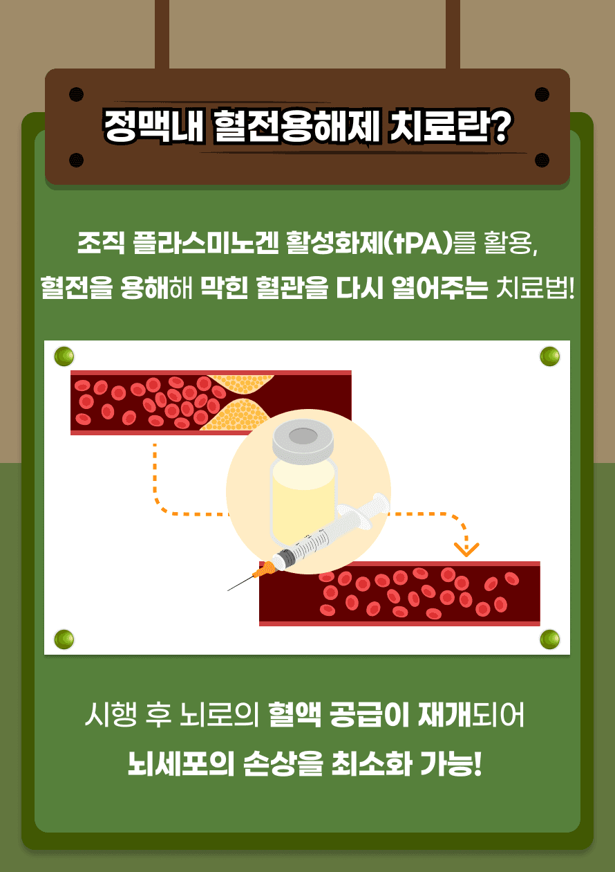 정맥내 혈전용해제 치료는 급성 허혈성 뇌졸중 환자에게 표준 치료로 권장됩니다. NIHSS(뇌졸중 중증도 평가) 점수를 기반으로 적응증을 판단하며, 출혈 위험성이 높을 경우 사용하지 않습니다. 이 치료는 주로 조직 플라스미노겐 활성화제(tPA)를 사용하며, 혈전을 용해해 막힌 혈관을 다시 열어주는 치료법입니다. 이러한 치료를 통해 뇌로의 혈액 공급이 재개되어 뇌세포의 손상을 최소화가 가능합니다.