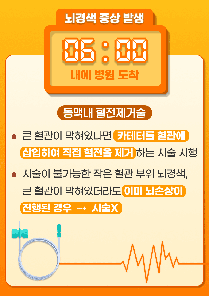 뇌경색 증상 발생 후 6시간 이내 병원에 도착하였다면 동맥내 혈전제거술을 시행해볼 수 있습니다. 동맥내 혈전제거술은 혈관 안에 직접 카테터를 넣어 혈전을 제거하는 시술로 뇌혈관 CT 상에서 큰 혈관이 막혀있는 경우 시술을 고려하게 됩니다. 침습적인 시술이다보니 모든 뇌경색 환자에게서 시행하지 않고 시술이 불가능한 작은 혈관 부위에 뇌경색이 생겼거나 큰 혈관이 막혀있더라도 이미 뇌손상이 진행되어서 시술에 이득이 없다고 판단할 경우 시술을 진행하지 않을 수도 있습니다. 시술을 진행하더라도 이미 진행된 뇌 손상은 돌아오지 않을 수 있으며, 뇌출혈이 발생할 수 있습니다.