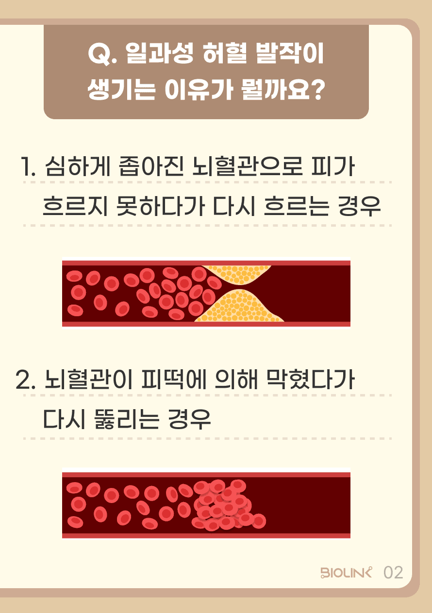 이러한 일과성 뇌허혈 발작이 발생하는 이유는 크게 두 가지로 생각할 수 있습니다. 1. 심하게 좁아진 뇌혈관으로 피가 흐르지 못하다가 다시 흐르는 경우 2. 뇌혈관이 피떡에 의해 막혔다가 다시 뚫리는 경우 결과적으로 일시적으로 뇌혈관이 막혔으나 뇌조직의 영구적인 손상이 발생하기 전 다시 뚫리는 경우를 말합니다.